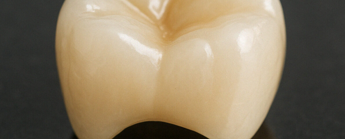 The Science Behind Crowns