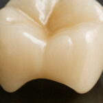 The Science Behind Crowns